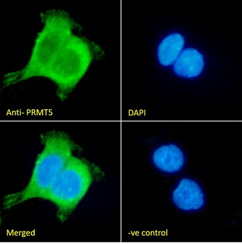 PRMT5 Antibody
