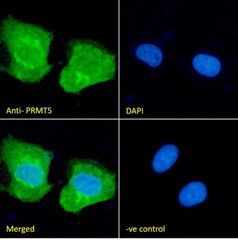 PRMT5 Antibody
