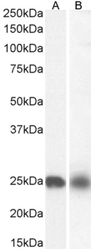NDUFS8 Antibody