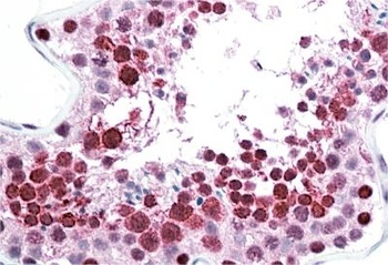 HSPC117 (aa201-215) Antibody