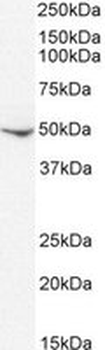 Positive Control Lysate for anti- DC-SIGN / CD209 antibody