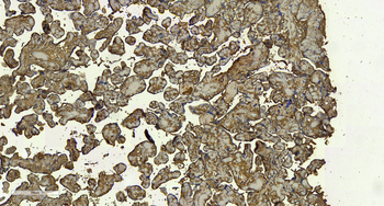 DC-SIGN/CD209 Antibody