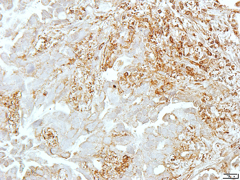 Goat Anti-Rabbit IgG (H+L) Antibody (HRP)