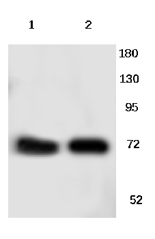 Gamma-adducin Rabbit Polyclonal Antibody
