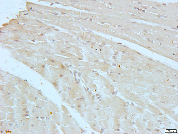 Gamma-adducin Rabbit Polyclonal Antibody