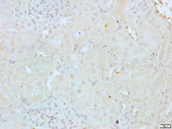 Gamma-adducin Rabbit Polyclonal Antibody