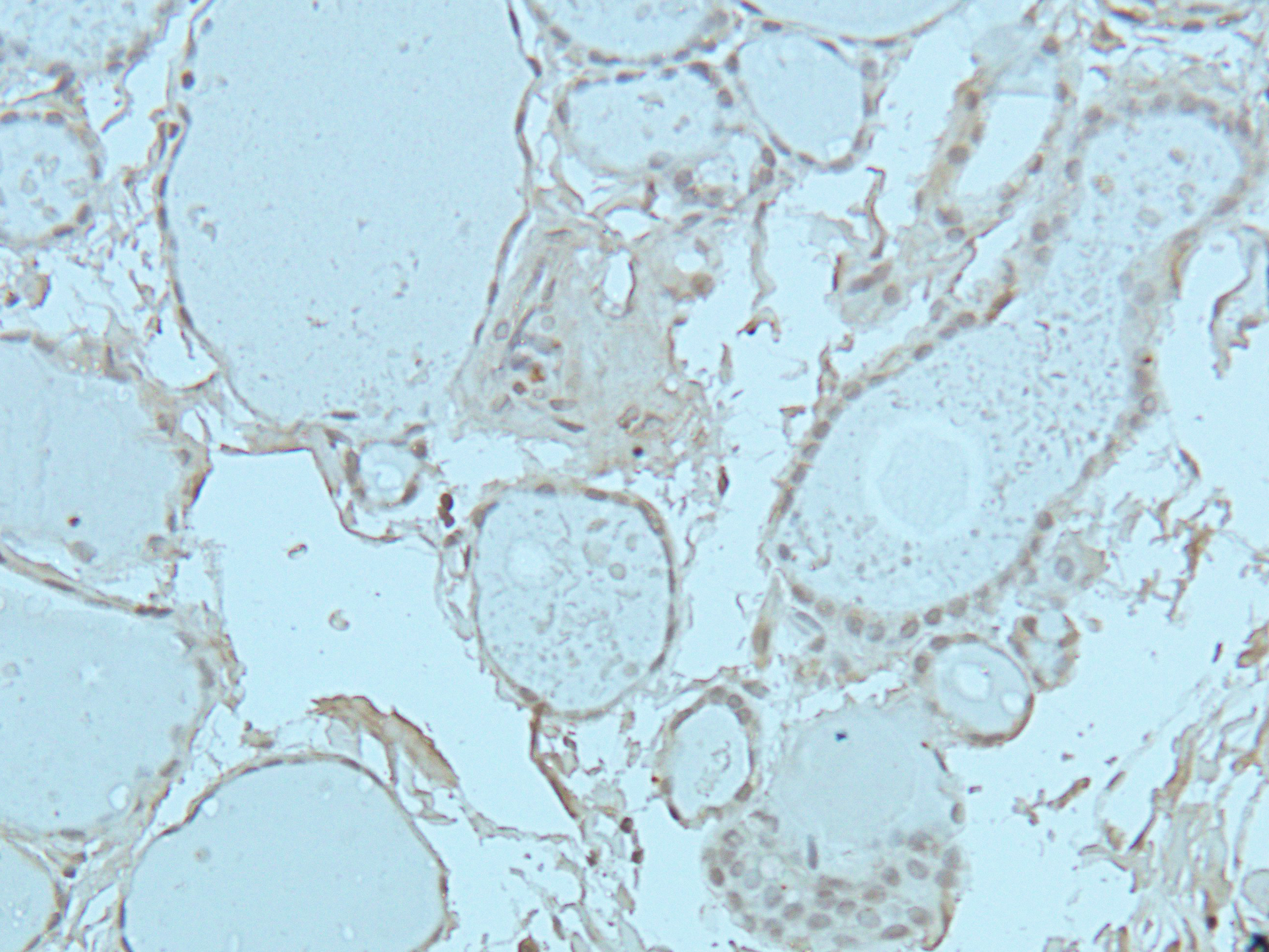 Annexin A6 Rabbit Polyclonal Antibody