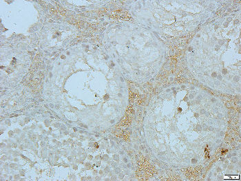 CD95 Rabbit Polyclonal Antibody