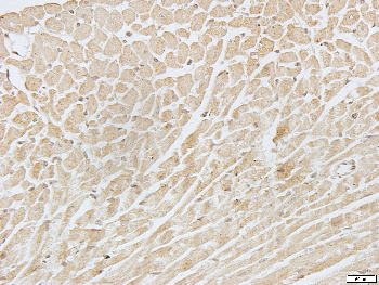 BCL2 Rabbit Polyclonal Antibody