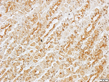 BCL2 Rabbit Polyclonal Antibody