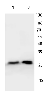 BCL2 Rabbit Polyclonal Antibody