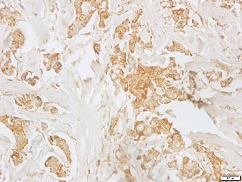 Calnexin Rabbit Polyclonal Antibody