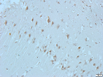 Cadherin 18 Rabbit Polyclonal Antibody