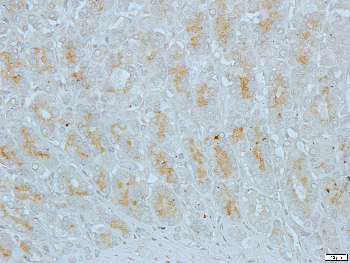 Cadherin 18 Rabbit Polyclonal Antibody