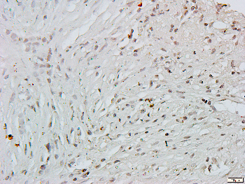 CstF-64 Rabbit Polyclonal Antibody