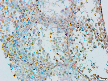CstF-64 Rabbit Polyclonal Antibody