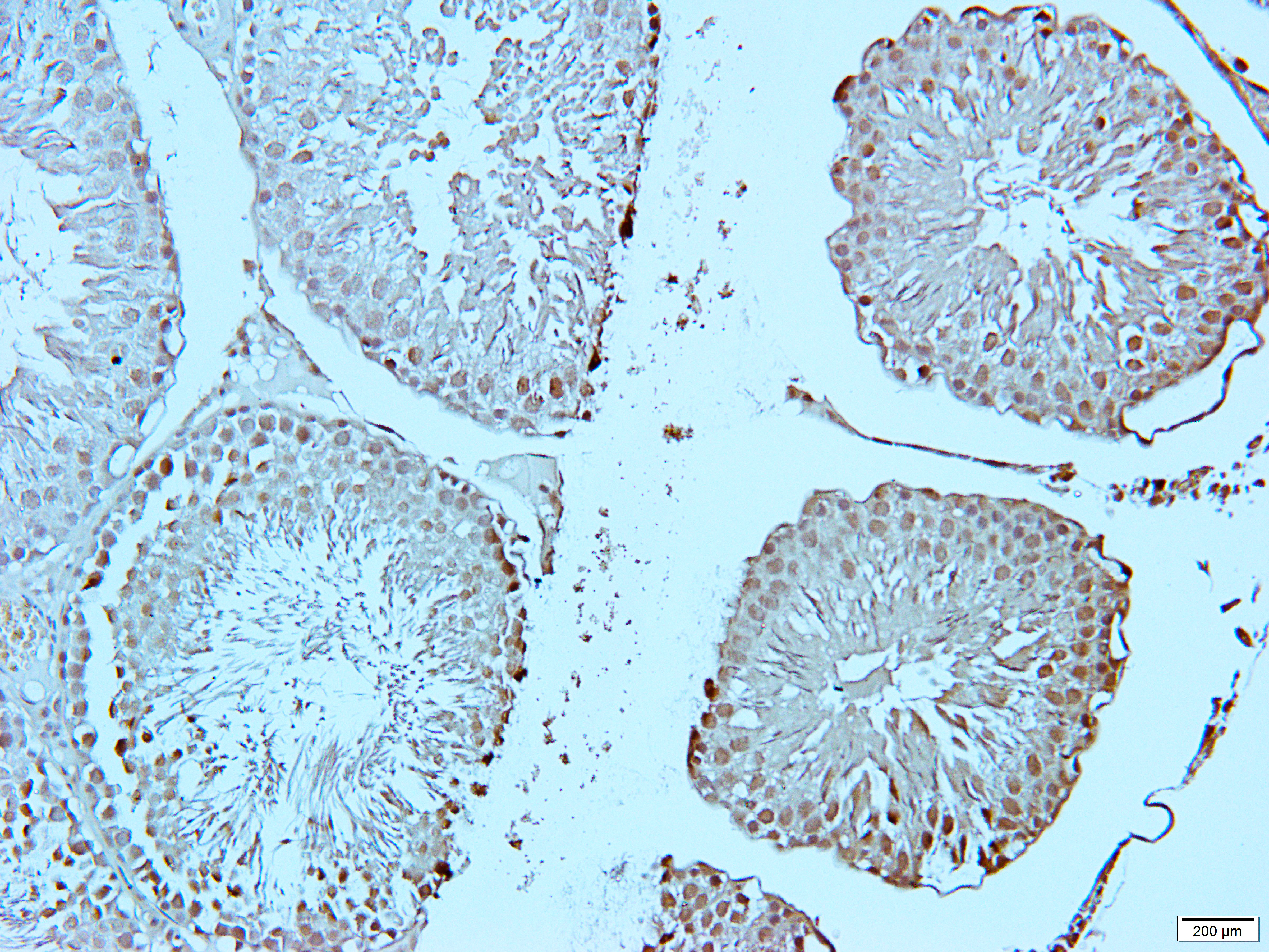 Gamma-enolase Rabbit Polyclonal Antibody