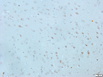 EPHA3 Rabbit Polyclonal Antibody