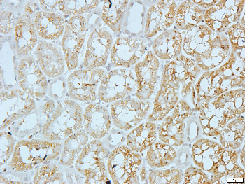 EPHA3 Rabbit Polyclonal Antibody