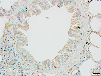 FR alpha Rabbit Polyclonal Antibody