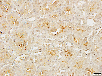FR alpha Rabbit Polyclonal Antibody
