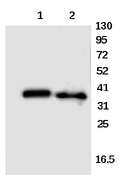 FR alpha Rabbit Polyclonal Antibody