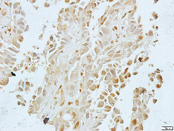 Galactose Kinase Rabbit Polyclonal Antibody