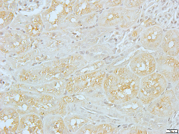 Galactose Kinase Rabbit Polyclonal Antibody