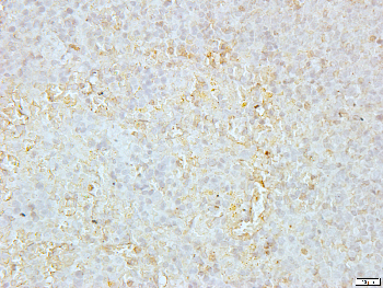 Galactose Kinase Rabbit Polyclonal Antibody