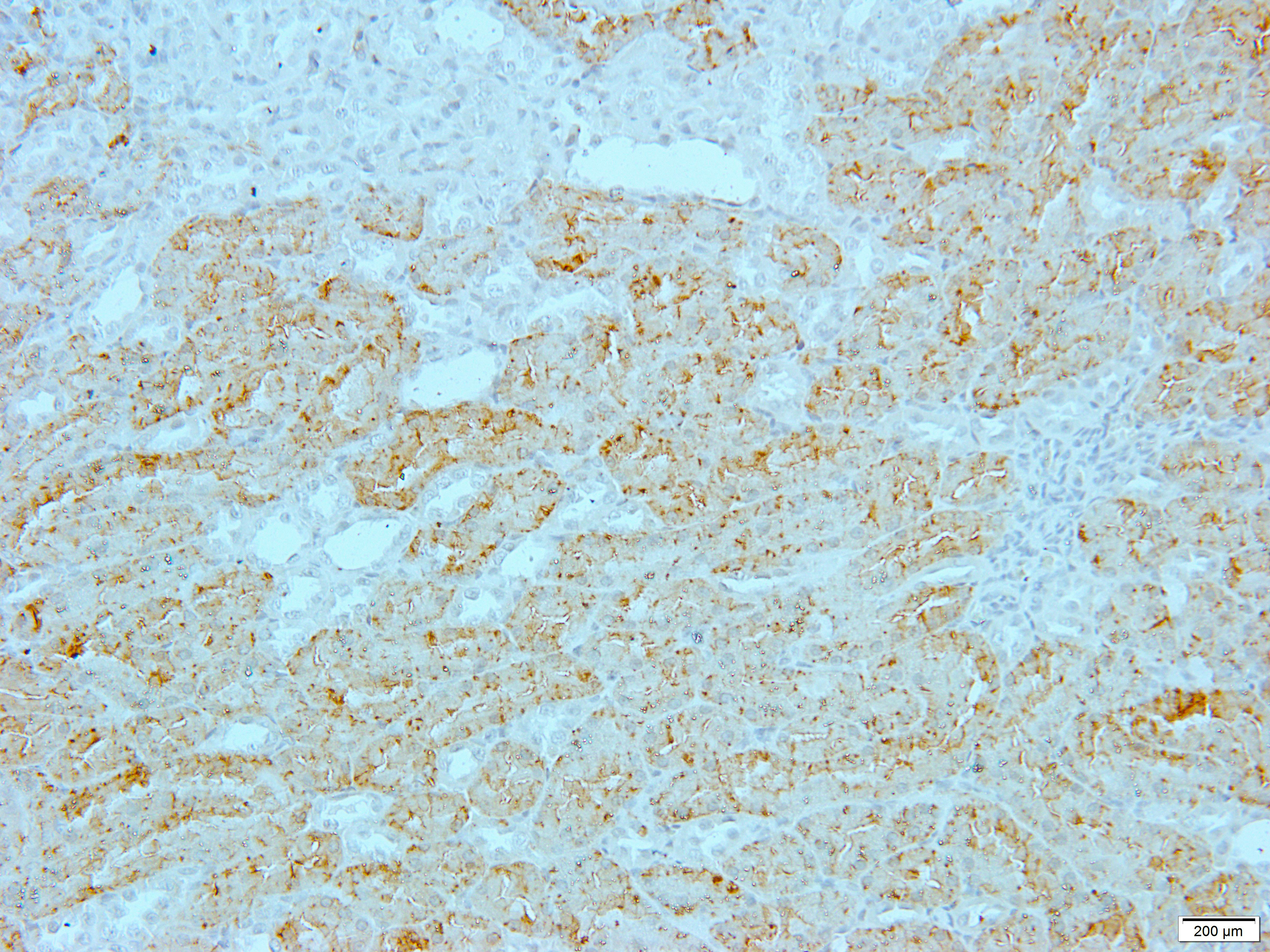 GCLC Rabbit Polyclonal Antibody