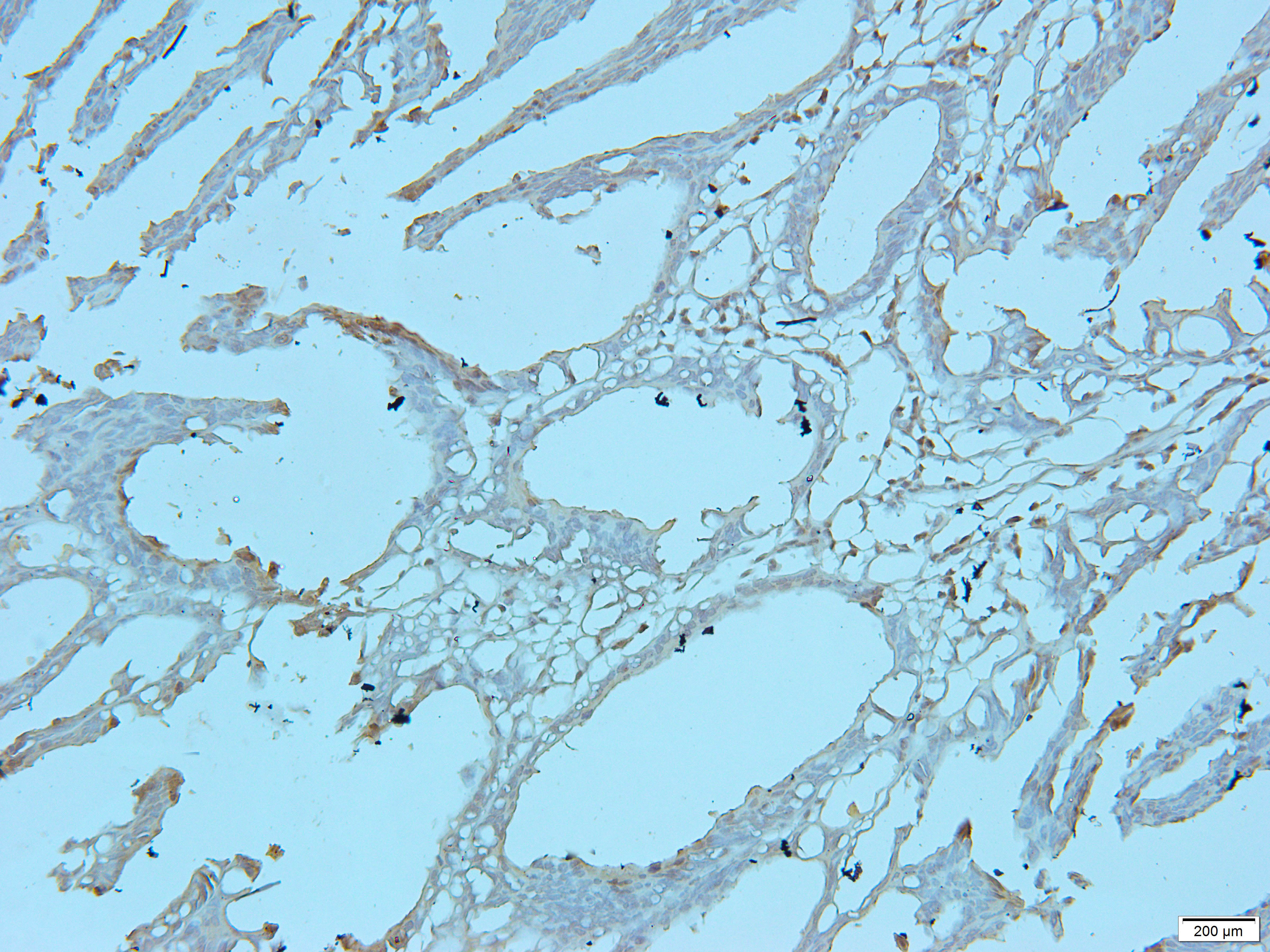 GOT1 Rabbit Polyclonal Antibody