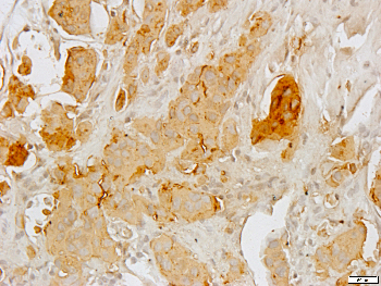 Cytokeratin 8 Rabbit Polyclonal Antibody
