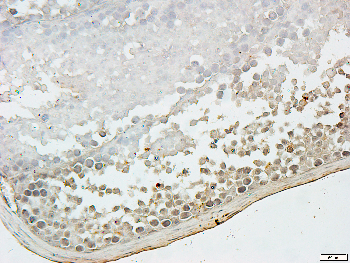 Cytokeratin 8 Rabbit Polyclonal Antibody