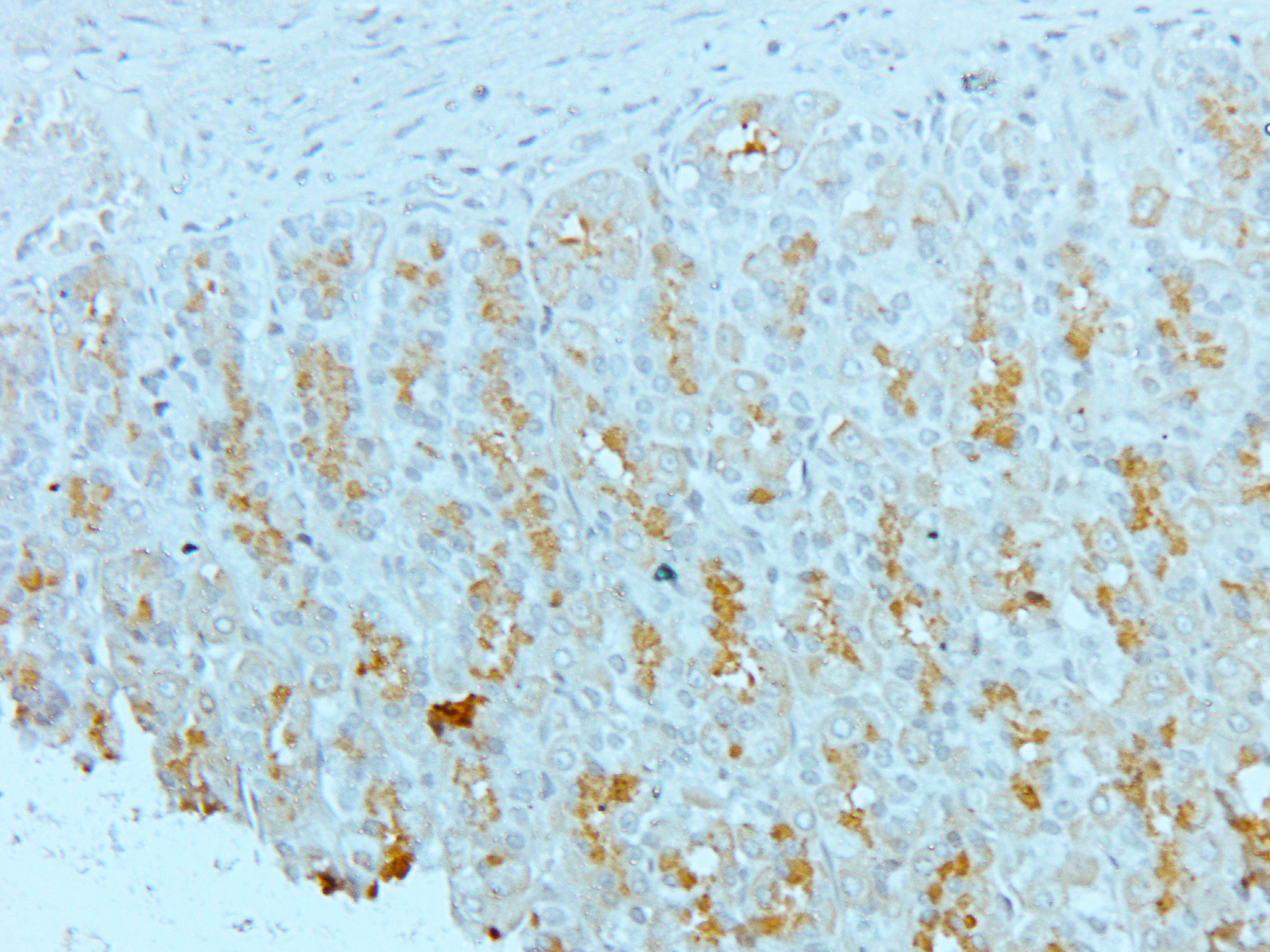 NBL1 Rabbit Polyclonal Antibody