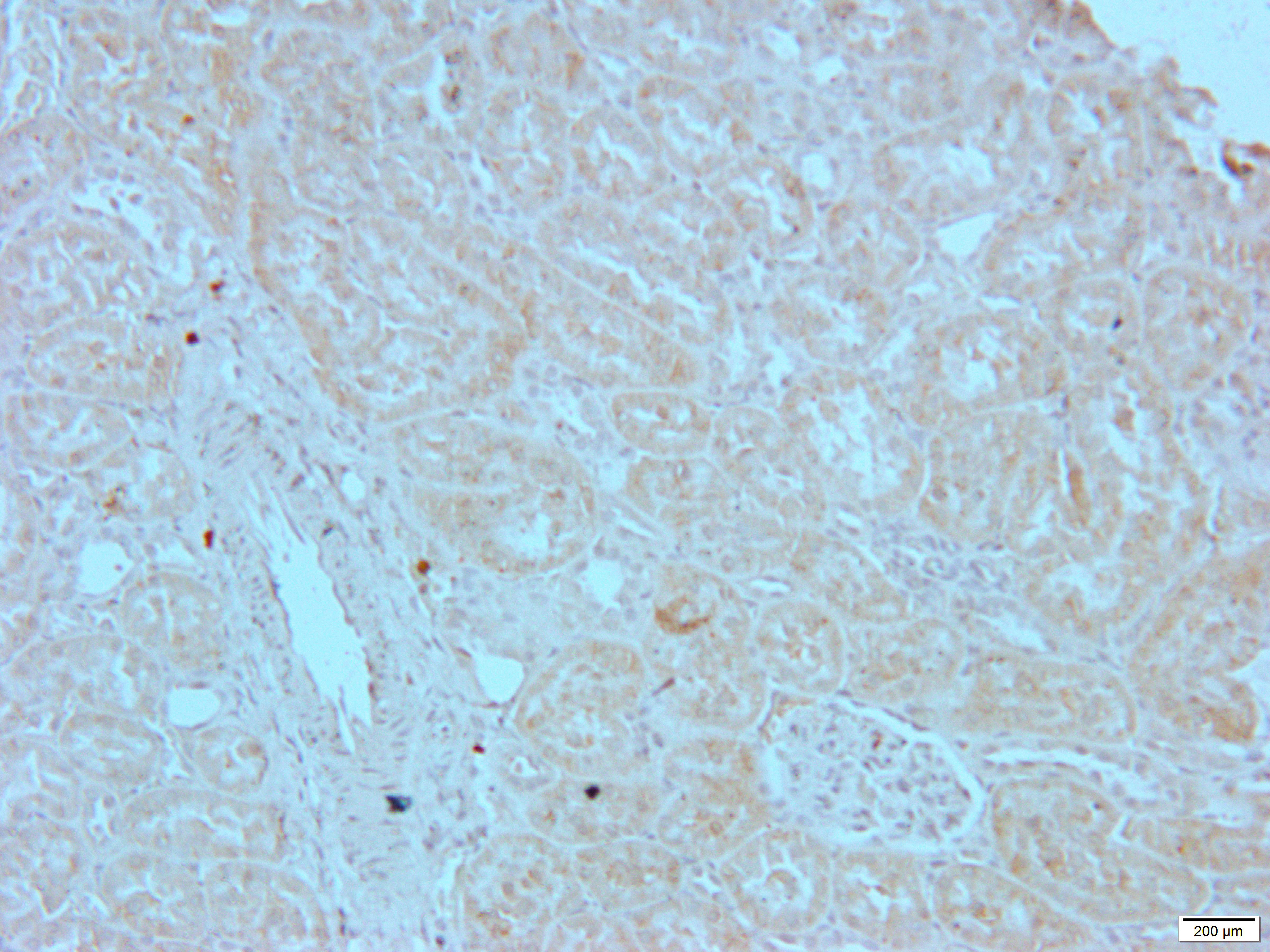 TRK B Rabbit Polyclonal Antibody
