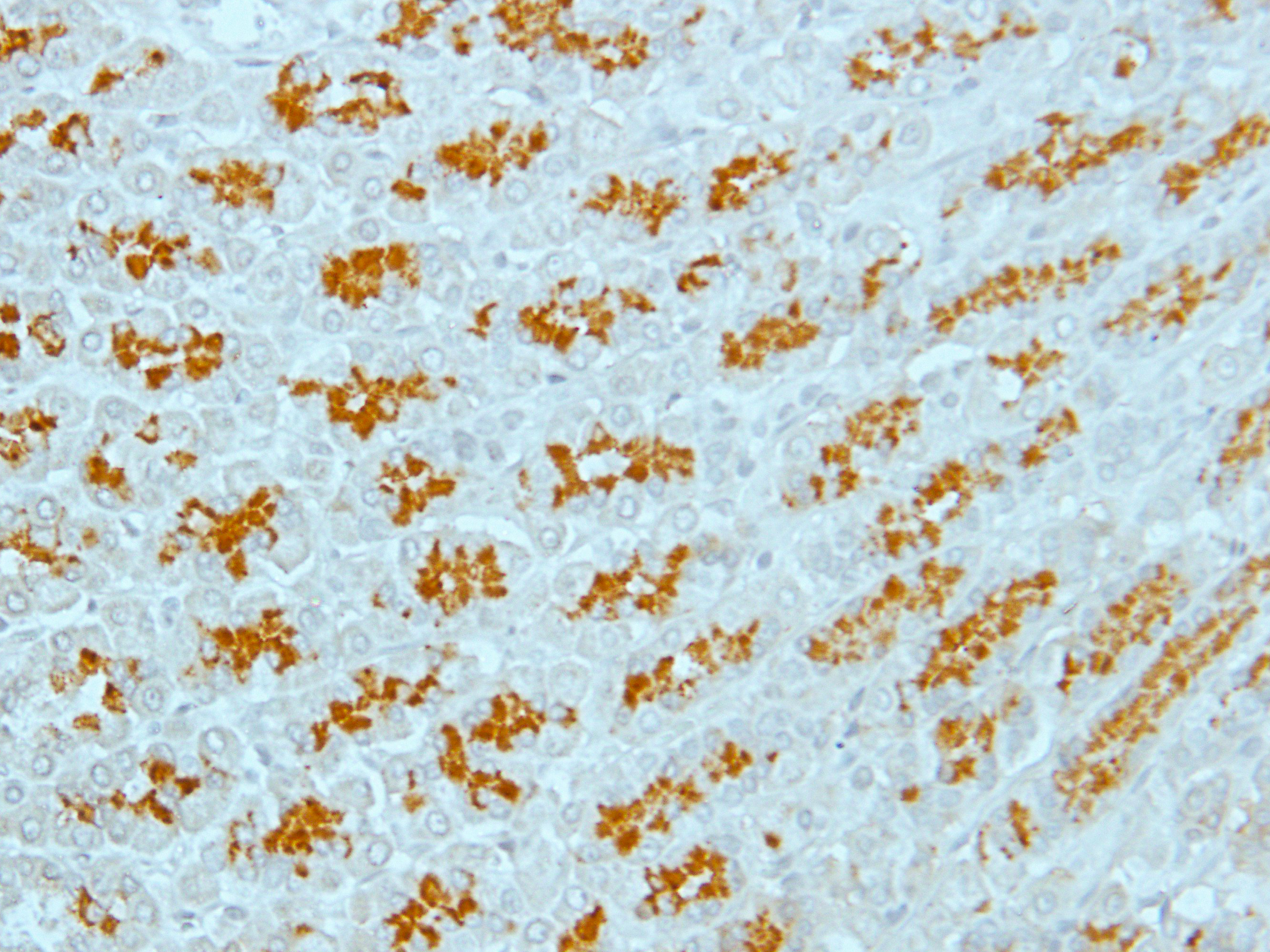 TRK B Rabbit Polyclonal Antibody