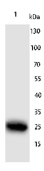 TIMP2 Rabbit Polyclonal Antibody