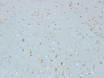 Merlin (Phospho-S518) Rabbit Polyclonal Antibody