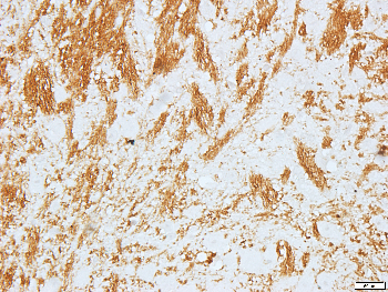 Histamine H3 Receptor Rabbit Polyclonal Antibody