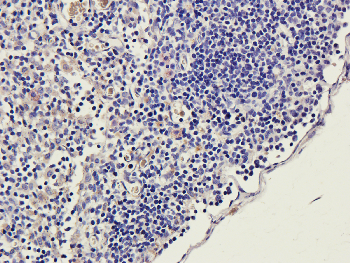 ICAM1 Mouse Monoclonal Antibody