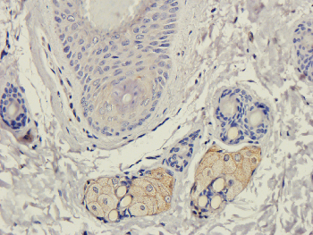 ICAM1 Mouse Monoclonal Antibody