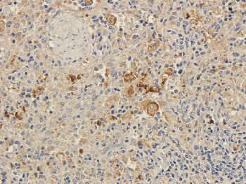 CD8 beta Mouse Monoclonal Antibody