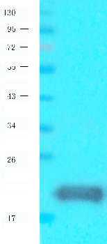 CD8 beta Mouse Monoclonal Antibody