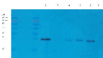 CD8 beta Mouse Monoclonal Antibody