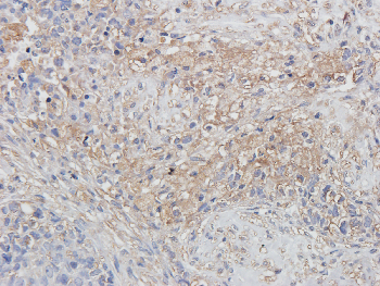 CD163 Mouse Monoclonal Antibody