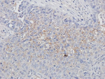 CD163 Mouse Monoclonal Antibody