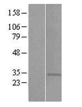 TAS2R5 Human Over-expression Lysate