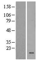 TAS2R13 Human Over-expression Lysate
