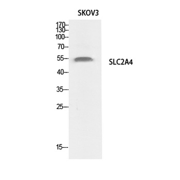 Glut4 Polyclonal Antibody