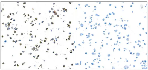 Granzyme B Antibody